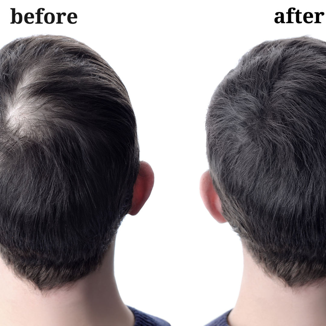 Hair Growth Starter Kit