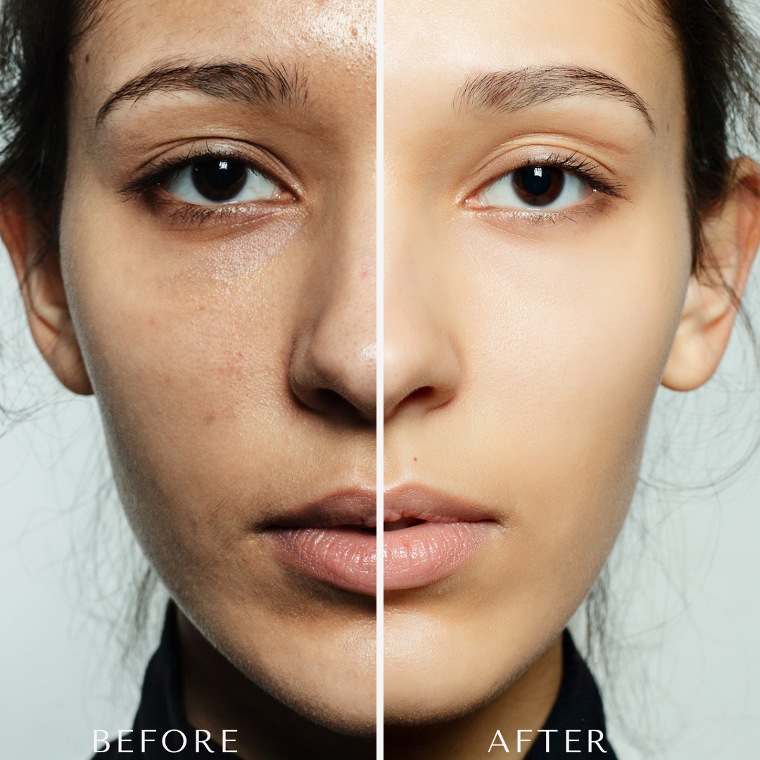 Brighten & Even Skin Tone Bundle– Fade Hyperpigmentation with Powerful Ingredients