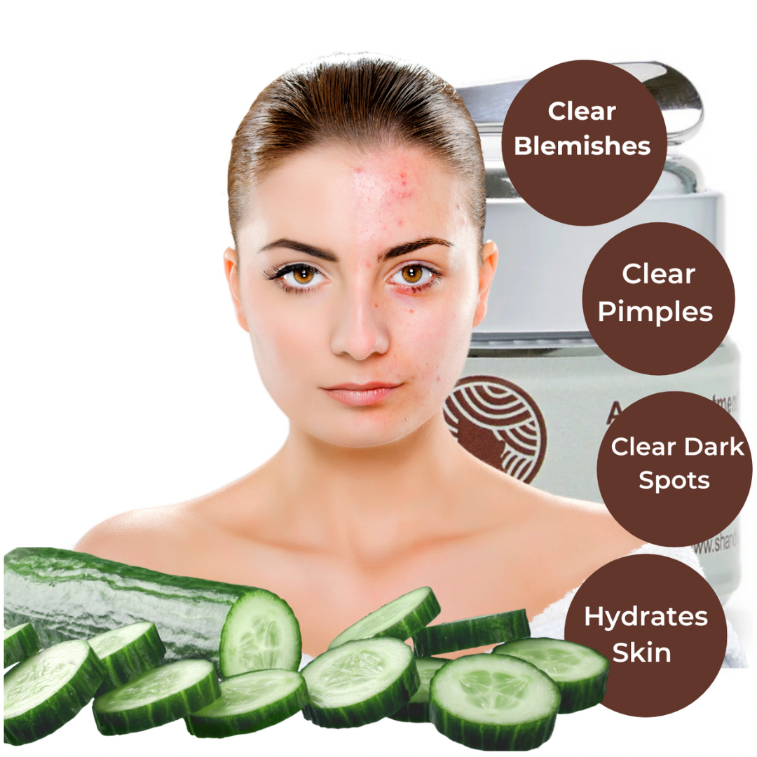 Acne Starter Kit