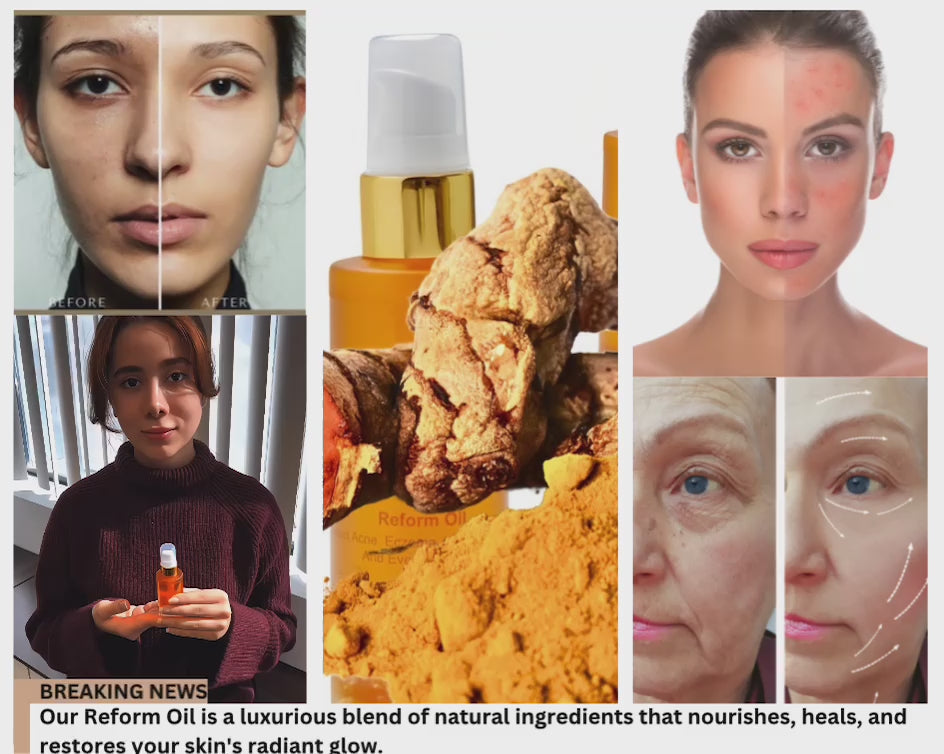 Introducing Our Reform Oil: Your Solution for Acne, Eczema, Wrinkles, Scars, and Uneven Skin Tone