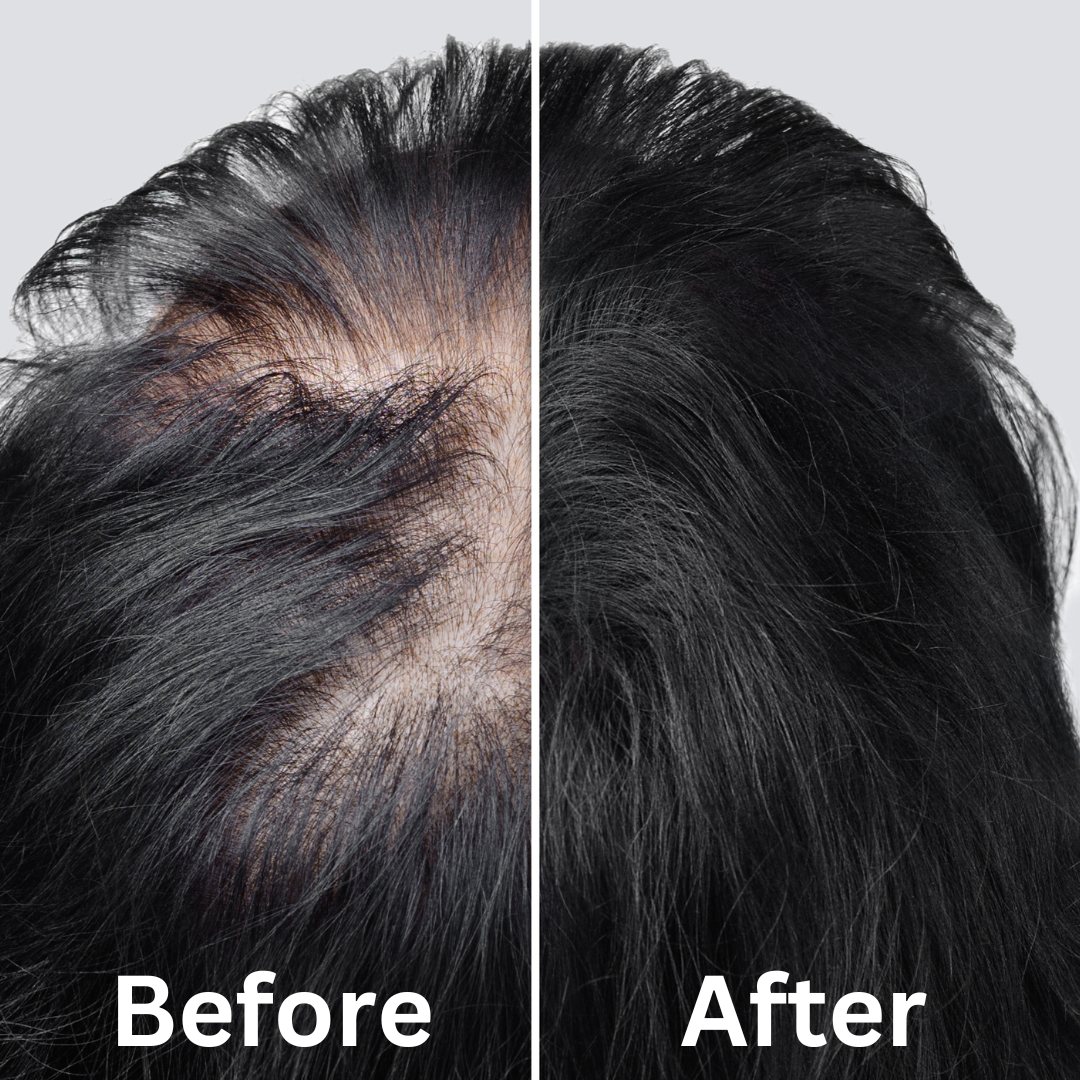 Hair Growth Tonic