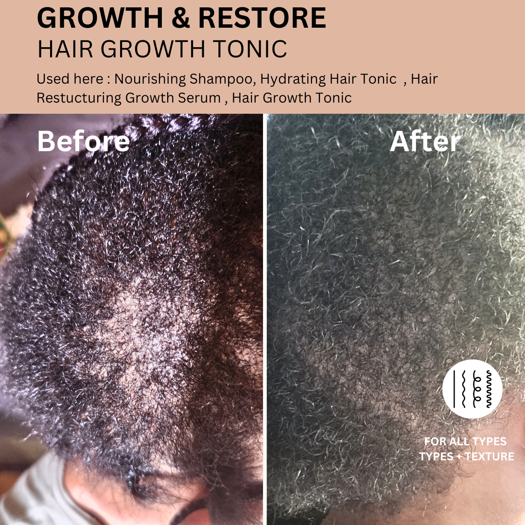 Hair Growth Tonic