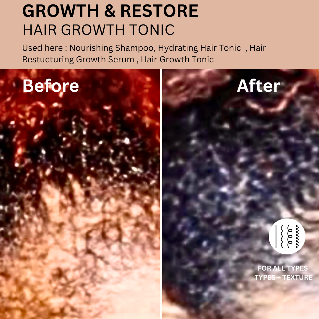 Hair Growth Tonic